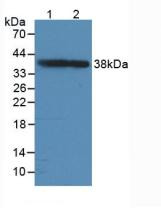 Western Blot; Sample: Lane1: Rat Brain Tissue; Lane2: Mouse Brain Tissue.