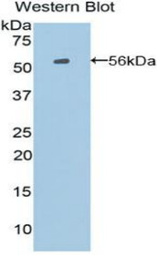 Western Blot; Sample: Recombinant protein.