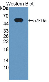 Western Blot; Sample: Recombinant protein.