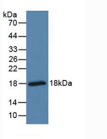 Western Blot; Sample: Mouse Brain Tissue.