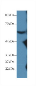 Western Blot; Sample: Mouse Serum; Primary Ab: 2µg/ml Rabbit Anti-Mouse C8b Antibody Second Ab: 0.2µg/mL HRP-Linked Caprine Anti-Rabbit IgG Polyclonal Antibody