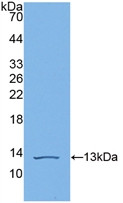 Western Blot; Sample: Recombinant C4b, Human.