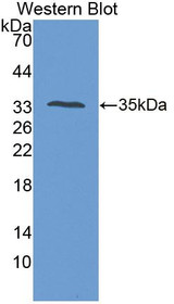 Western Blot; Sample: Recombinant protein.