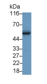 Western Blot; Sample: Recombinant protein.