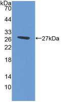 Western Blot; Sample: Recombinant ABCG1, Human.