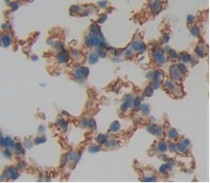 Used in DAB staining on fromalin fixed paraffin- embedded Kidney tissue