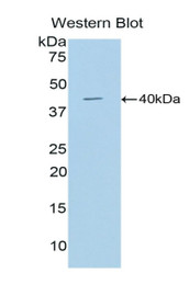 Western Blot; Sample: Recombinant protein.