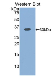 Western Blot; Sample: Recombinant protein.