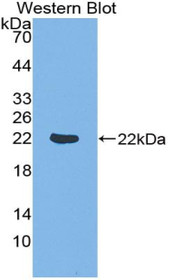 Western Blot; Sample: Recombinant protein.