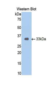 Western Blot; Sample: Recombinant protein.