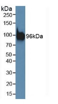 Western Blot; Sample: Mouse Brain Tissue.