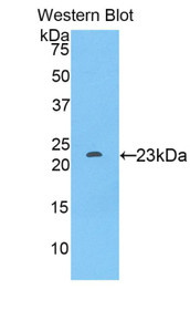 Western Blot; Sample: Recombinant protein.