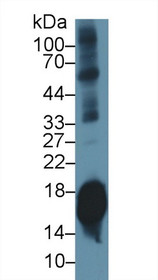 Western Blot; Sample: Mouse Cerebrum lysate; Primary Ab: 1µg/ml Rabbit Anti-Mouse SNCa Antibody Second Ab: 0.2µg/mL HRP-Linked Caprine Anti-Rabbit IgG Polyclonal Antibody