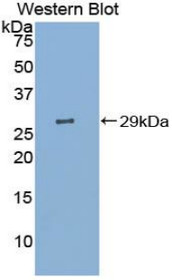 Western Blot; Sample: Recombinant protein.