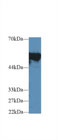Western Blot; Sample: Mouse Cerebrum lysate; Primary Ab: 2µg/ml Rabbit Anti-Mouse FGb Antibody Second Ab: 0.2µg/mL HRP-Linked Caprine Anti-Rabbit IgG Polyclonal Antibody