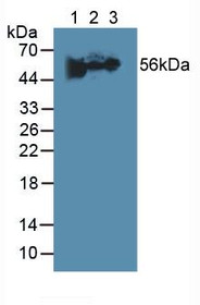 Western Blot; Sample: Lane1: Human Urine; Lane2: Mouse Heart Tissue; Lane3: Porcine Brain Tissue.