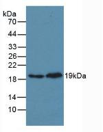 Western Blot; Sample. Lane1: Mouse Heart Tissue; Lane2: Rat Heart Tissue.
