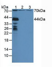 Western Blot; Sample: Lane1: Mouse Liver Tissue; Lane2: Human Hela Cells; Lane3: Human HepG2 Cells.