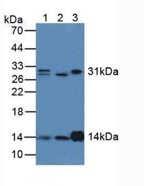 Western Blot; Sample: Lane1: Human Lung Tissue; Lane2: Human Liver Tissue; Lane3: Rat Kidney Tissue.