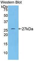 Western Blot; Sample: Recombinant protein.