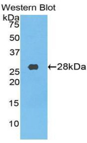 Western Blot; Sample: Recombinant protein.
