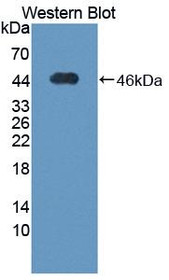 Western Blot; Sample: Recombinant protein.