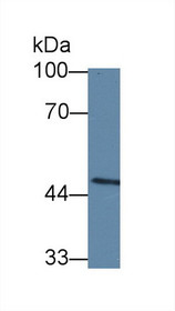 Western Blot; Sample: Mouse Spleen lysate; Primary Ab: 5µg/ml Rabbit Anti-Human CASP10 Antibody Second Ab: 0.2µg/mL HRP-Linked Caprine Anti-Rabbit IgG Polyclonal Antibody