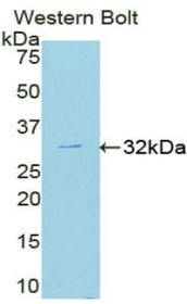 Western Blot; Sample: Recombinant protein.