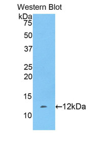 Western Blot; Sample: Recombinant protein.