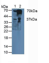 Western Blot; Sample: Lane1: Human Liver Tissue; Lane2: Human Blood Cells.