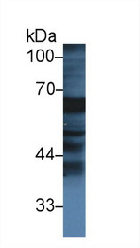 Western Blot; Sample: Bovine Small intestine lysate; Primary Ab: 1µg/ml Rabbit Anti-Bovine FGa Antibody Second Ab: 0.2µg/mL HRP-Linked Caprine Anti-Rabbit IgG Polyclonal Antibody