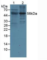Western Blot; Sample: Lane1: Mouse Lymphonodus Tissue; Lane2: Human Liver Tissue.