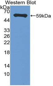 Western Blot; Sample: Recombinant protein.