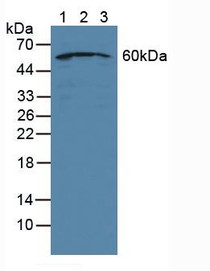 Western Blot; Sample: Lane1: Human Jurkat Cells; Lane2: Human Hela Cells; Lane3: Human HepG2 Cells.