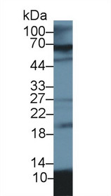 Western Blot; Sample: Porcine Lung lysate; Primary Ab: 2µg/ml Rabbit Anti-Porcine S100A12 Antibody Second Ab: 0.2µg/mL HRP-Linked Caprine Anti-Rabbit IgG Polyclonal Antibody