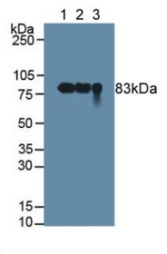 Western Blot; Sample: Lane1: Human Milk; Lane2: Human Urine; Lane3: Human Saliva.