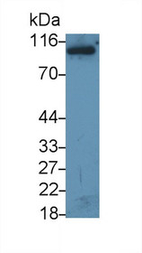 Western Blot; Sample: Recombinant protein.