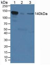 Western Blot; Sample: Lane1: Mouse Serum; Lane2: Mouse Placenta Tissue; Lane3: Human Hela Cells.