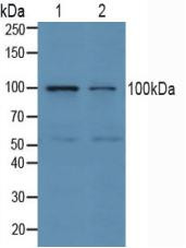 Western Blot; Sample: Lane1: Human Jurkat Cells; Lane2: Human K562 Cells.
