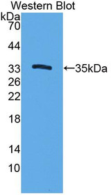 Western Blot; Sample: Recombinant protein.
