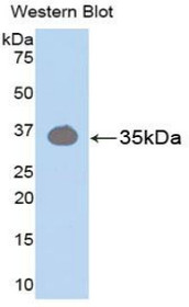 Western Blot; Sample: Recombinant protein.