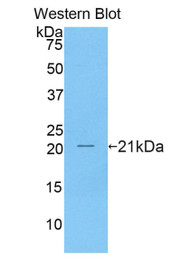 Western Blot; Sample: Recombinant protein.