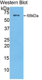 Western Blot; Sample: Recombinant protein.