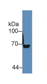 Albumin (ALB) Polyclonal Antibody, CAU26643
