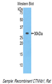 Western Blot; Sample: Recombinant protein.