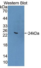 Western Blot; Sample: Recombinant protein.