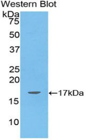 Western Blot; Sample: Recombinant protein.