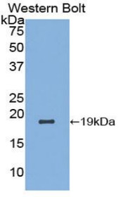 Western Blot; Sample: Recombinant protein.