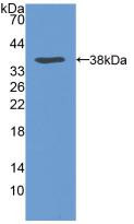 Western Blot; Sample: Recombinant VLDLR, Human.