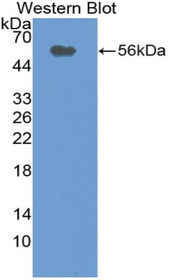 Western Blot; Sample: Recombinant protein.